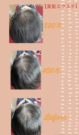 🌈美髪増毛🌈薄い生え際、薄毛、白髪隠しのトップに🥰ファイバー毛を地毛一本に2〜4本結びつけます💕お試し400本