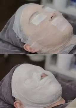 超小顔造顔コルギ+高級石膏パック60