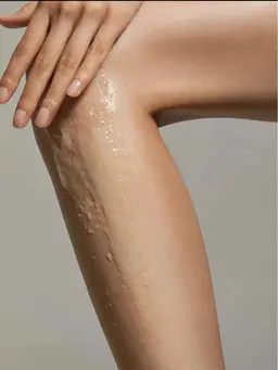 【1ヶ所◆パーツ脱毛】お好きな部位が選べる！肌に優しいピンポイント脱毛♪