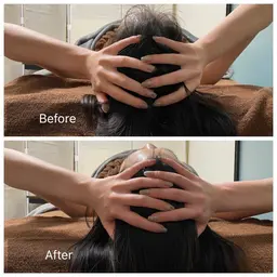 ヘッドトリートメント