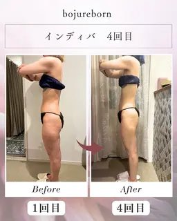 【人気No.1】お悩みオーダーメイド インディバボディ60分