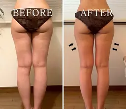 【再来】美脚コース　¥7800 リンパマッサージ/水素フットバス/よもぎ蒸し　100分