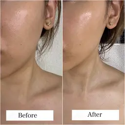 【ご新規様＊造形美】頭蓋骨小顔矯正+パイラナイトケア　通常19,000円→ミニモ限定初回12,200円