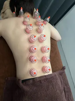 【体質改善】肩こり・不調改善！全身筋膜リリース・リンパマッサージ＋カッピング