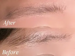 ハリウッドブロウリフト