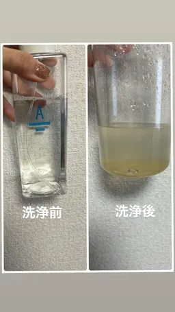 【毛穴洗浄】毛穴の黒ずみ、ざらつきにハイドラフェイシャル♪もっちり肌に！