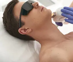 メンズ| 全顔脱毛