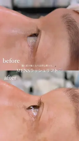 MENSラッシュリフト◆自然なカールで瞳に輝きを(コーティング仕上げ)