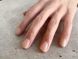 ネイルオフのみ