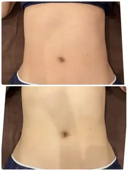 特許取得キャビゼロ☆理想のボディラインへ😊１部位（２０分コース）