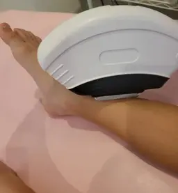 ミニモ価格【15歳まで拡大✤キッズ脱毛】Lパーツ１箇所