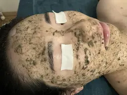 10回のエステより1回のハーブ！次世代幹細胞ハーブTM★当日予約は要電話★ダウンタイムがほぼなく人気です♪メンズ可