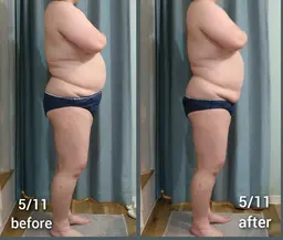 90分ボディ【デトックスコース】疲労・むくみ・ダイエット・体質見直しなど❗お悩みに合わせた施術をします♪