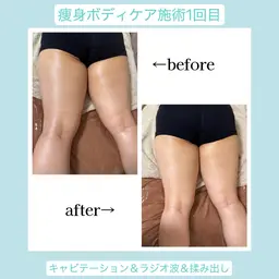 【大人気‼️】メリハリボディ痩身👙《2部位》 もみほぐし込× 耳つぼジュエリー💎