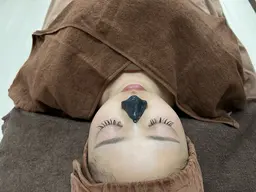 毛穴洗浄&ひきしめ美容鍼コース