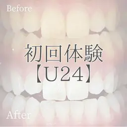 【ミニモ学割ホワイトニング🦷✨】おためし¥2,000✨2回目以降もコスパがいいからホワイトニング始めやすいです😊