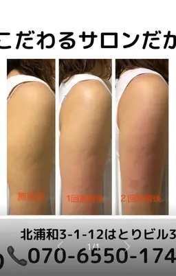 🌻ミニモ限定🌻二の腕痩せコース60分