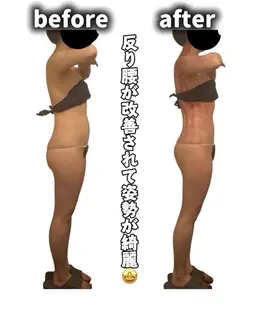 全身スライドカッピング◆初回モニター