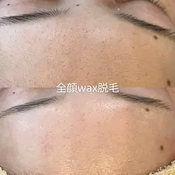 顔ワックス脱毛×保湿・毛穴洗浄パック