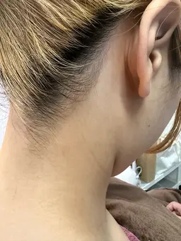 本日限定✨お顔シェービング＋シートパック＋うなじからお背中3分の1シェービング