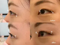 ⛓️パーマの持続力UP⛓️似合わせまつ毛パーマ➕ケラチンコーティング＆アイシャンプー付き🎀