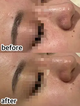 【韓国肌管理】水光肌艶ララピールxハイドロ毛穴洗浄🇰🇷