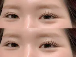 フラットラッシュ 100本