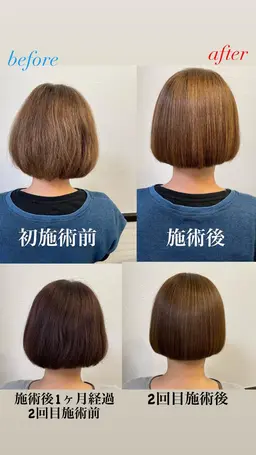 酸熱トリートメント