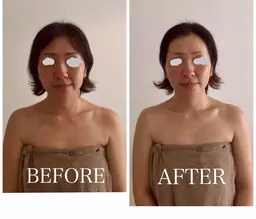 小顔矯正×小顔リンパケア40分