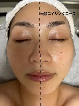 マッサージ重視!!深層リンパフェイシャル　60分