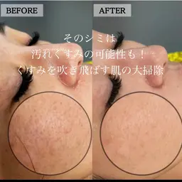 【minimo限定特別価格】プレミアム肌育ジェルエステで肌の喜びと変化をご体感ください☆