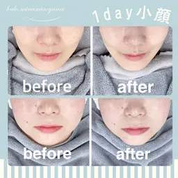 【７０分】お顔のスタンプ6P＋小顔Vライン形成☆W機器