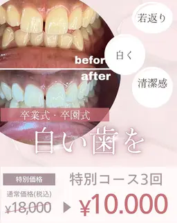 【卒業式・卒園式】特別コース3回