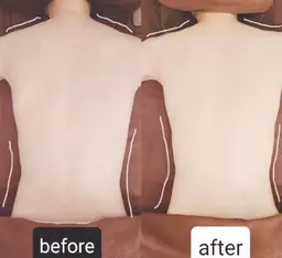 ☆お試し☆癒されながらW痩身！炭酸×キャビテーション60分￥15000→￥10000