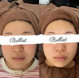 小顔リフトアップ✨シンプルコース