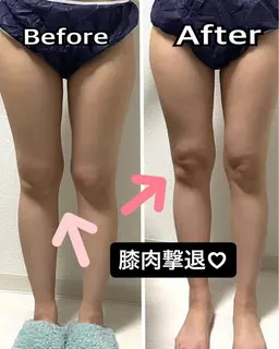 むくみスッキリ！スラリ足痩せコース✨キャビテーション→（マッサージorラジオ波吸引）→EMS岩盤マット（60分）