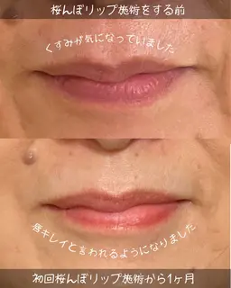 【唇のくすみが気になる方】🌸桜んぼリップカウンセリング＋ドライヘッドマッサージ30分／2,000円🌸