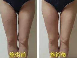 20分間引き締め痩身🍀お試し1箇所✨