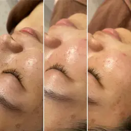 美肌への近道🌻毛穴ケア体験コース