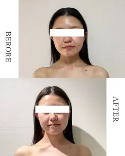 🌿小顔矯正コルギ練習モデル価格🌿