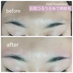 【お肌つるつる糸で顔脱毛* フェイスコース】うぶ毛✨ひげ✨ボサボサ眉毛✨化粧ノリアップ‼️
