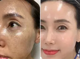 最新韓国美容インセルダム🇰🇷体験