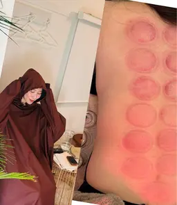 【黄土よもぎ蒸し30分＋肩背中腰カッピング】温めた後更にカッピングで羽が生えたような体へ👼✨