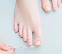 【Foot】自爪戻し