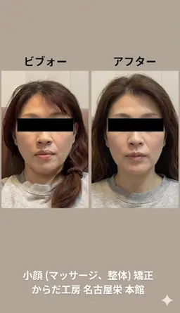 女性限定《ミニモ学割＆U26》美容整体180分◆究極の全身フル調整！30年実績の小顔・美尻を極める最長コースで私にご褒美