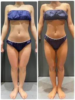 U24限定🎄クリスマスまでに全身ケア🔥くびれ肩こりむくみセルライトケア