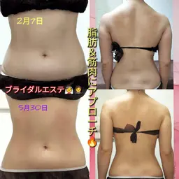 夏に向けて🌈痩身プレミアムコース(100分コース)🌈機械を使って、筋肉＆脂肪にアプローチ🔥