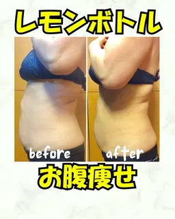 【ダイエット100人チャレンジ】半永久🍋お腹痩せ1回9,800円メンズ可能🉑痛み、ダウンタイムなし!