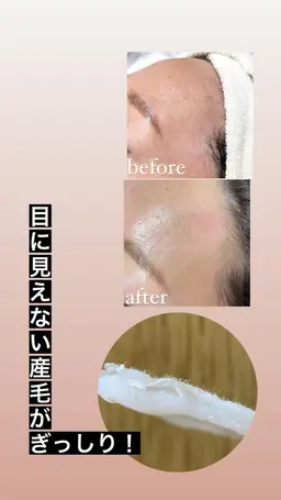 🌿フェイシャルWAX脱毛🌿高密度パック付き🤍🤎