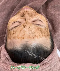 ⭐︎剥離しない！ハーブピーリング⭐︎ダウンタイムなし！直後からメイクOK！毛穴、くすみ、むくみ、たるみ等お悩みに！